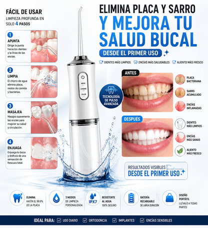 IRRIGADOR DENTAL PRO